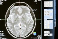 Suppress Crime, Scientists Propose Chip Implants in Criminal Brains