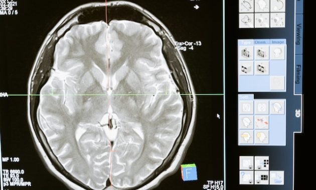 Suppress Crime, Scientists Propose Chip Implants in Criminal Brains