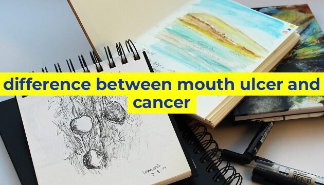 difference between mouth ulcer and cancer