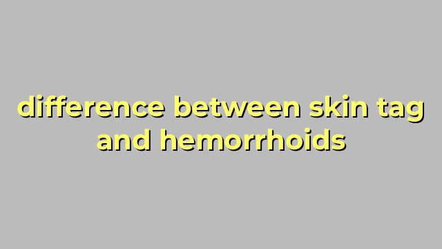 difference between skin tag and hemorrhoids